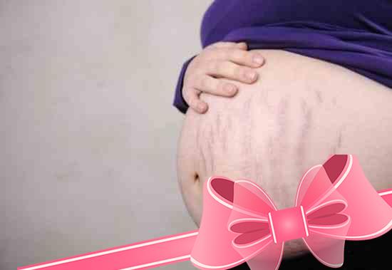 Эффективные средства устранения растяжек при беременности: советы специалистов