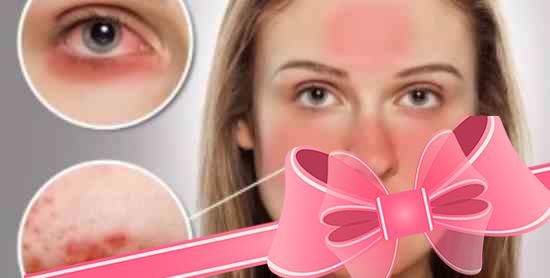 Заболевание кожи лица розацеа: как лечить?