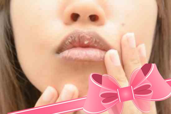 Сухость губ, жжение и трещины: причины и лечение