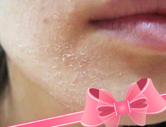 Рецепты эффективных масок для очень сухой кожи лица